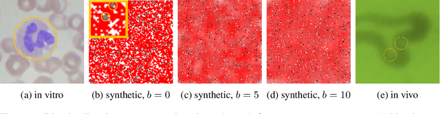 Figure 2 for Application of Deep Learning Methods to Processing of Noisy Medical Video Data