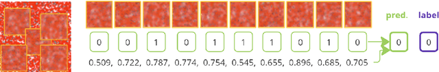 Figure 4 for Application of Deep Learning Methods to Processing of Noisy Medical Video Data