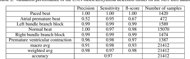 Figure 4 for Explainable AI (XAI) for Arrhythmia detection from electrocardiograms