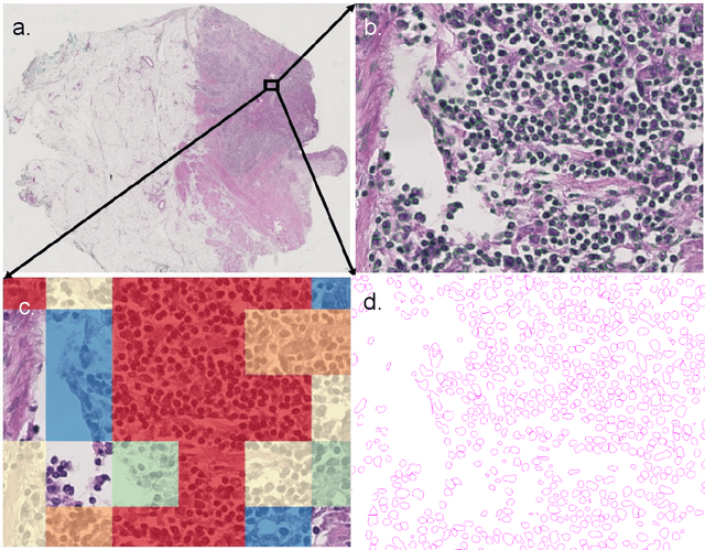 Figure 1 for Halcyon -- A Pathology Imaging and Feature analysis and Management System