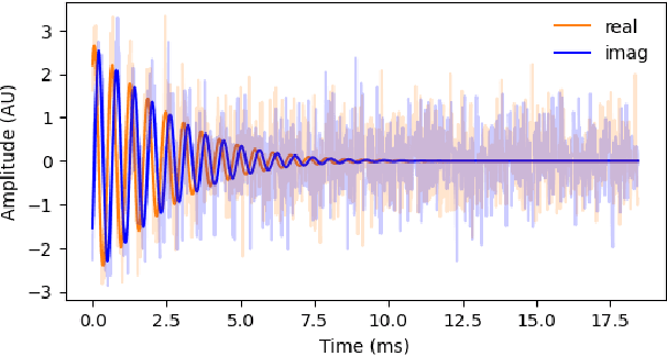 Figure 1 for Denoising neural networks for magnetic resonance spectroscopy