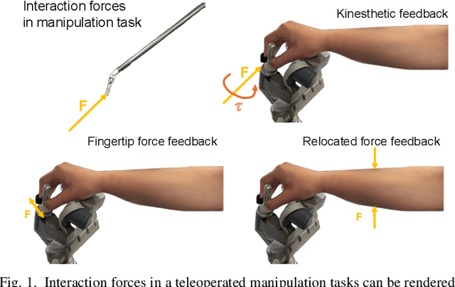 Figure 1 for Effects of Wrist-Worn Haptic Feedback on Force Accuracy and Task Speed during a Teleoperated Robotic Surgery Task