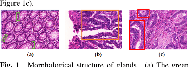 Figure 1 for Gland segmentation via dual encoders and boundary-enhanced attention