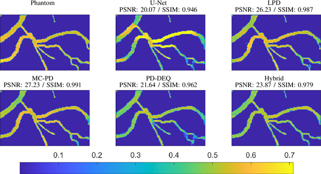 Figure 2 for Model-corrected learned primal-dual models for fast limited-view photoacoustic tomography