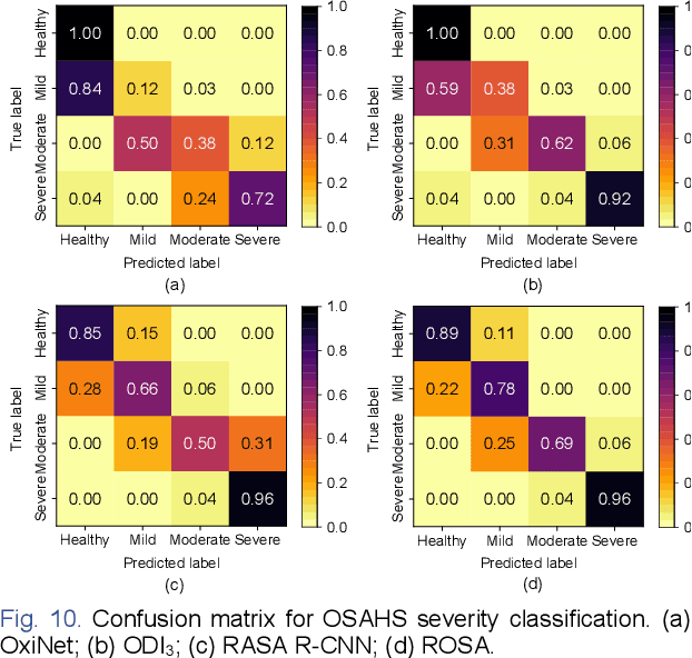 Figure 2 for Fusion of Millimeter-wave Radar and Pulse Oximeter Data for Low-burden Diagnosis of Obstructive Sleep Apnea-Hypopnea Syndrome