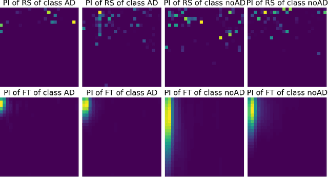 Figure 3 for Alzheimer Disease Detection from Raman Spectroscopy of the Cerebrospinal Fluid via Topological Machine Learning