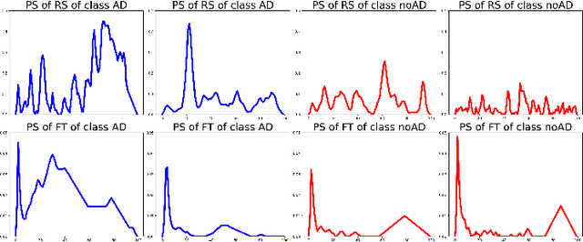 Figure 4 for Alzheimer Disease Detection from Raman Spectroscopy of the Cerebrospinal Fluid via Topological Machine Learning