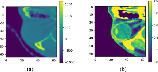 Figure 4 for Deep-learning Segmentation of Small Volumes in CT images for Radiotherapy Treatment Planning