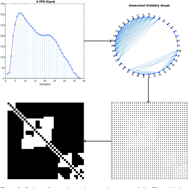 Figure 4 for Amplitude-Independent Machine Learning for PPG through Visibility Graphs and Transfer Learning