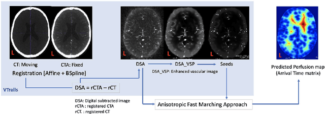 Figure 1 for Framework to generate perfusion map from CT and CTA images in patients with acute ischemic stroke: A longitudinal and cross-sectional study