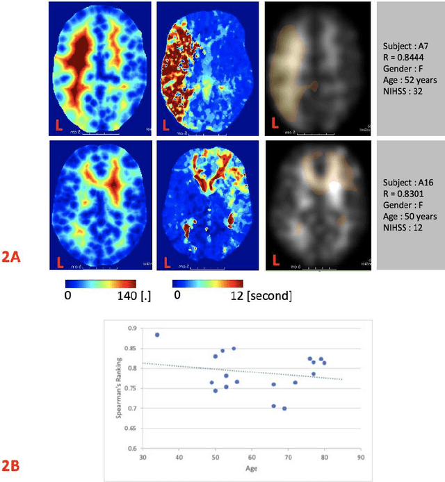 Figure 3 for Framework to generate perfusion map from CT and CTA images in patients with acute ischemic stroke: A longitudinal and cross-sectional study