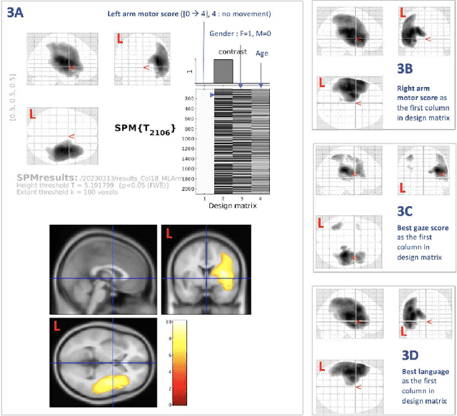 Figure 4 for Framework to generate perfusion map from CT and CTA images in patients with acute ischemic stroke: A longitudinal and cross-sectional study