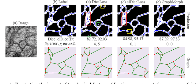 Figure 1 for GraphMorph: Tubular Structure Extraction by Morphing Predicted Graphs