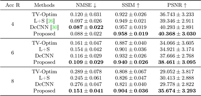 Figure 2 for Global k-Space Interpolation for Dynamic MRI Reconstruction using Masked Image Modeling
