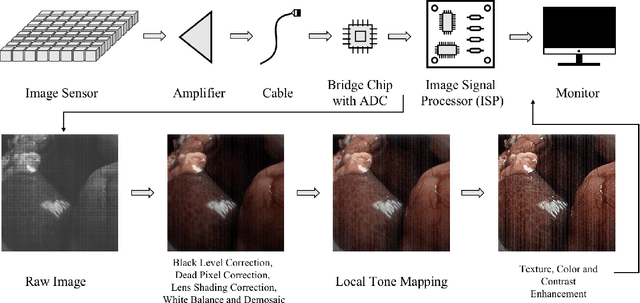 Figure 1 for A Real-time Endoscopic Image Denoising System