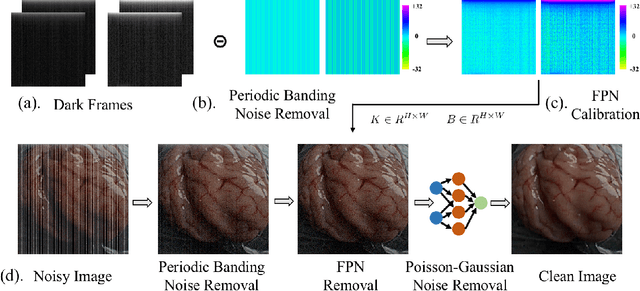 Figure 3 for A Real-time Endoscopic Image Denoising System