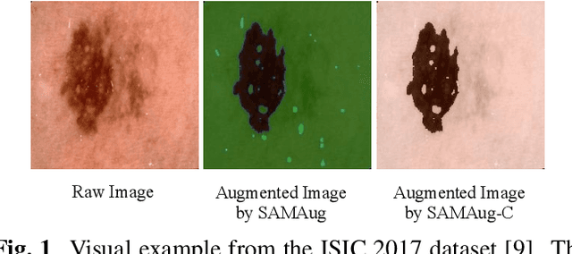 Figure 1 for Boosting Medical Image Classification with Segmentation Foundation Model