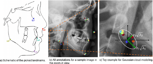 Figure 1 for Reliability of deep learning models for anatomical landmark detection: The role of inter-rater variability