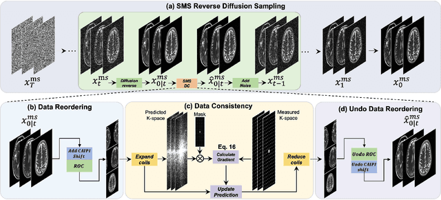 Figure 1 for Robust Simultaneous Multislice MRI Reconstruction Using Deep Generative Priors