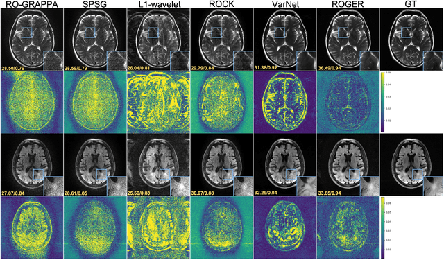 Figure 2 for Robust Simultaneous Multislice MRI Reconstruction Using Deep Generative Priors