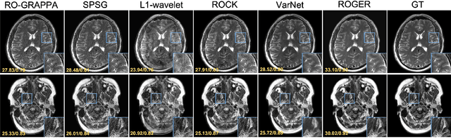 Figure 4 for Robust Simultaneous Multislice MRI Reconstruction Using Deep Generative Priors