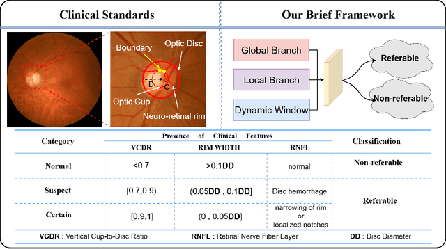 Figure 1 for Enhancing Fundus Image-based Glaucoma Screening via Dynamic Global-Local Feature Integration