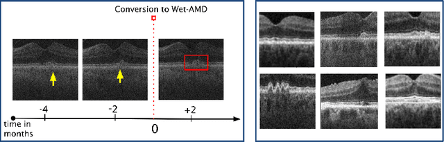 Figure 3 for Time-Equivariant Contrastive Learning for Degenerative Disease Progression in Retinal OCT