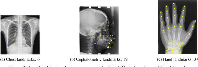 Figure 3 for Self-supervised pre-training with diffusion model for few-shot landmark detection in x-ray images