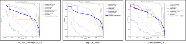 Figure 3 for Global Context Modeling in YOLOv8 for Pediatric Wrist Fracture Detection