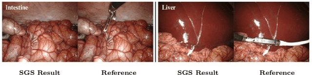 Figure 1 for Surgical Gaussian Surfels: Highly Accurate Real-time Surgical Scene Rendering