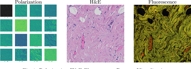 Figure 1 for Diffusion-based Virtual Staining from Polarimetric Mueller Matrix Imaging