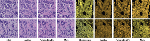 Figure 3 for Diffusion-based Virtual Staining from Polarimetric Mueller Matrix Imaging