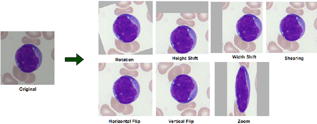 Figure 3 for A Hybrid Feature Fusion Deep Learning Framework for Leukemia Cancer Detection in Microscopic Blood Sample Using Gated Recurrent Unit and Uncertainty Quantification