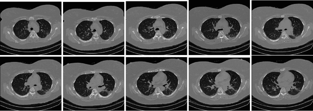 Figure 4 for Domain adaptation, Explainability & Fairness in AI for Medical Image Analysis: Diagnosis of COVID-19 based on 3-D Chest CT-scans