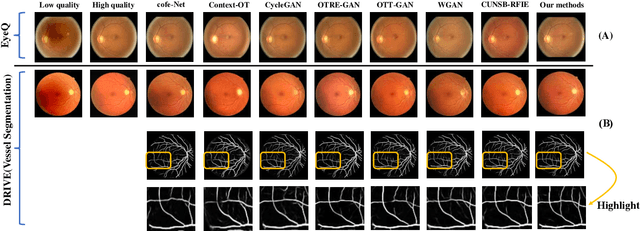 Figure 3 for TPOT: Topology Preserving Optimal Transport in Retinal Fundus Image Enhancement