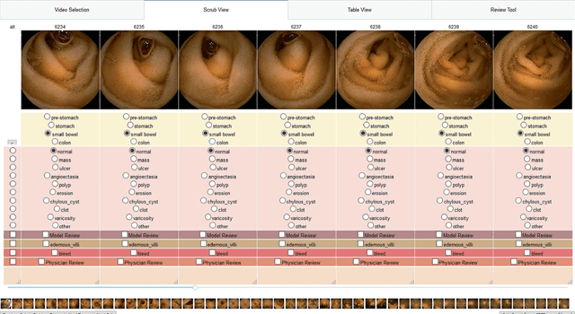 Figure 2 for The intersection of video capsule endoscopy and artificial intelligence: addressing unique challenges using machine learning