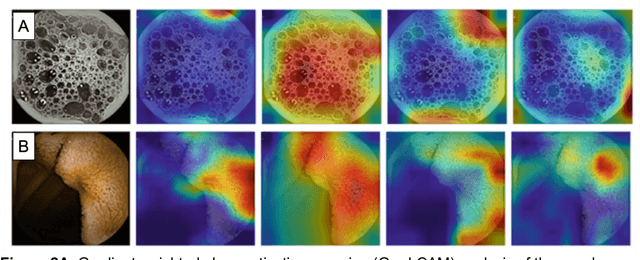 Figure 4 for The intersection of video capsule endoscopy and artificial intelligence: addressing unique challenges using machine learning