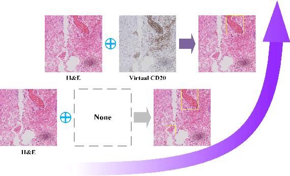 Figure 1 for Histology Virtual Staining with Mask-Guided Adversarial Transfer Learning for Tertiary Lymphoid Structure Detection