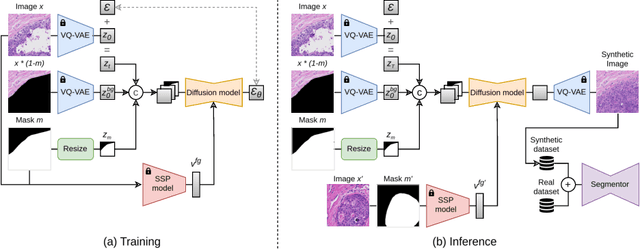 Figure 3 for PathoPainter: Augmenting Histopathology Segmentation via Tumor-aware Inpainting