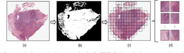 Figure 1 for Efficient Whole Slide Image Classification through Fisher Vector Representation