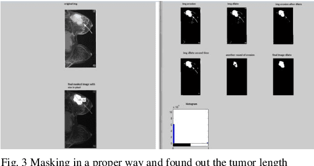 Figure 2 for Development of an interactive GUI using MATLAB for the detection of type and stage of Breast Tumor