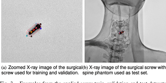 Figure 3 for Advancing 6-DoF Instrument Pose Estimation in Variable X-Ray Imaging Geometries