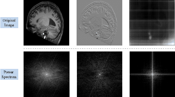 Figure 2 for MRNet: Multifaceted Resilient Networks for Medical Image-to-Image Translation