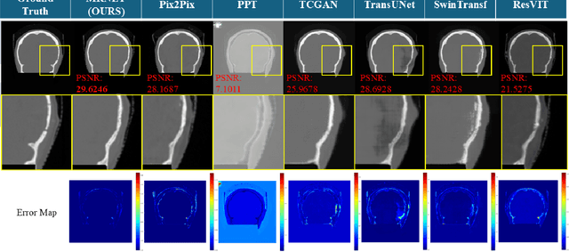 Figure 3 for MRNet: Multifaceted Resilient Networks for Medical Image-to-Image Translation