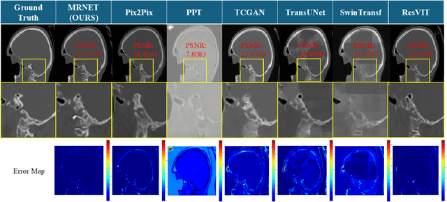 Figure 4 for MRNet: Multifaceted Resilient Networks for Medical Image-to-Image Translation