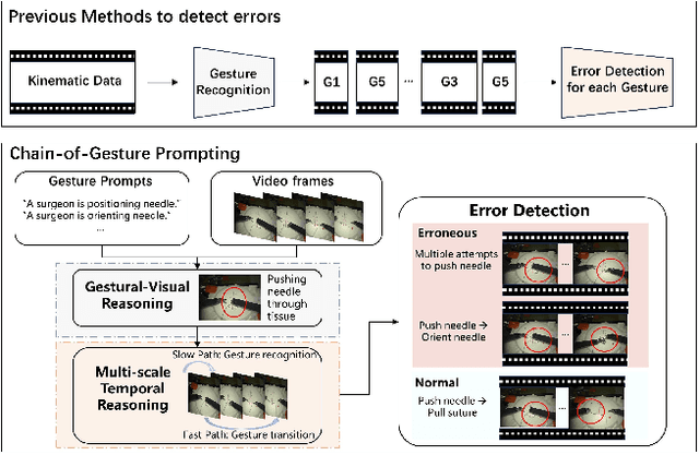 Figure 1 for Think Step by Step: Chain-of-Gesture Prompting for Error Detection in Robotic Surgical Videos