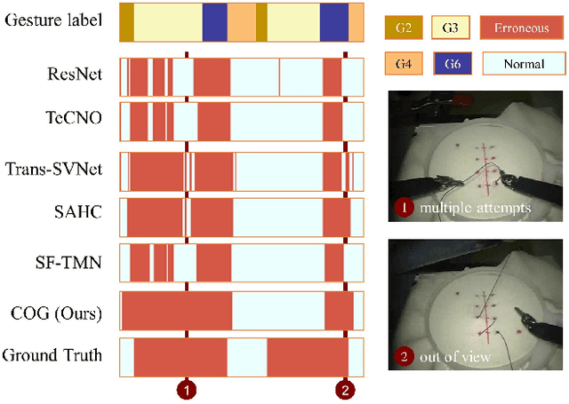 Figure 4 for Think Step by Step: Chain-of-Gesture Prompting for Error Detection in Robotic Surgical Videos