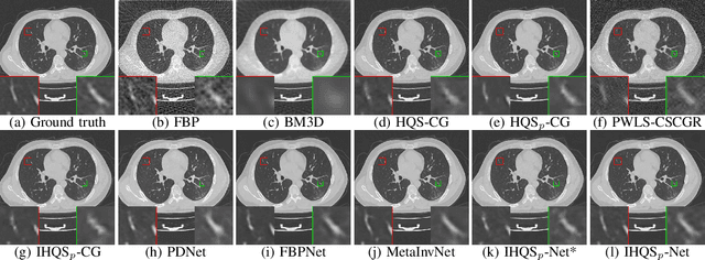 Figure 2 for Deep Inertia $L_p$ Half-Quadratic Splitting Unrolling Network for Sparse View CT Reconstruction