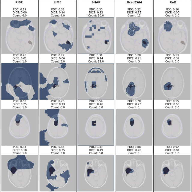 Figure 4 for MRxaI: Black-Box Explainability for Image Classifiers in a Medical Setting