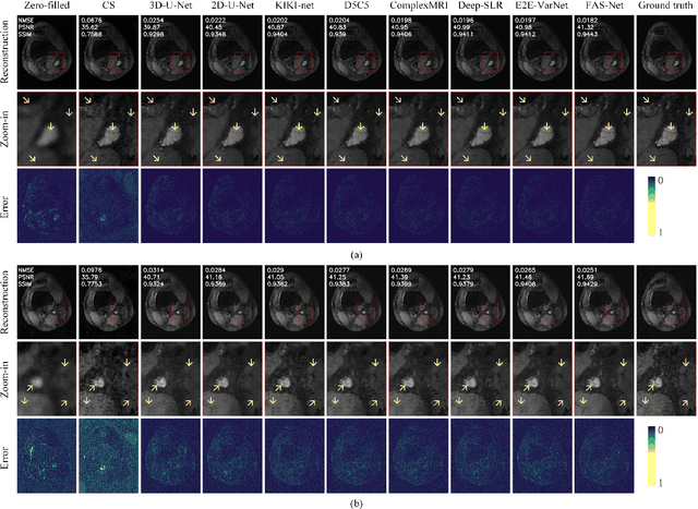 Figure 3 for Image Reconstruction for Accelerated MR Scan with Faster Fourier Convolutional Neural Networks